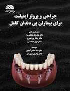 جراحی و پروتز ایمپلنت برای بیماران بی دندان کامل