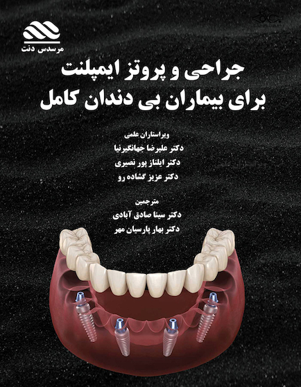 جراحی و پروتز ایمپلنت برای بیماران بی دندان کامل