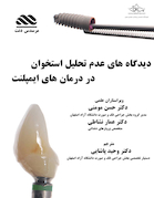 دیدگاه های عدم تحلیل استخوان در درمان های ایمپلنت