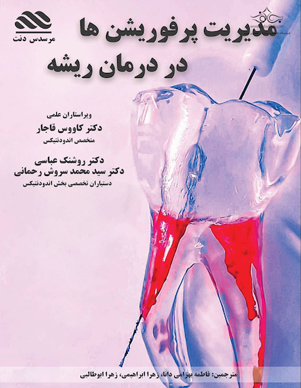 مدیریت پرفوریشن ها در درمان ریشه