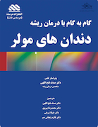 گام به گام با درمان ریشه دندان های مولر
