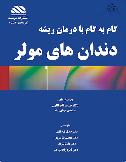 گام به گام با درمان ریشه دندان های مولر