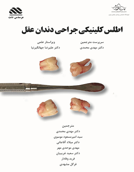 اطلس کلینیکی جراحی دندان عقل