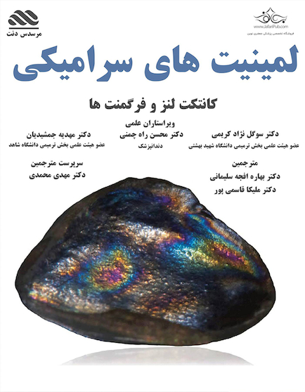 لمینیت های سرامیکی دکتر نژاد کریمی