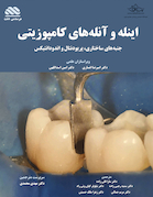 اینله و آنله های کامپوزیتی