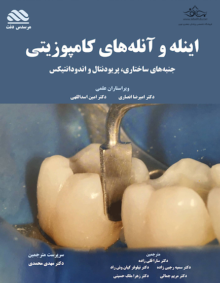 اینله و آنله های کامپوزیتی