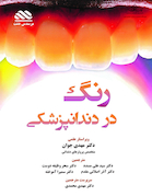 رنگ در دندانپزشکی