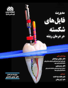 مدیریت فایل های شکسته در درمان ریشه