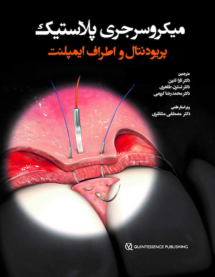 میکروسرجری پلاستیک پریودنتال و اطراف ایمپلنت