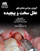 آموزش جراحی دندان های عقل سخت و پیچیده