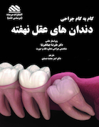 گام به گام جراحی دندان های عقل نهفته