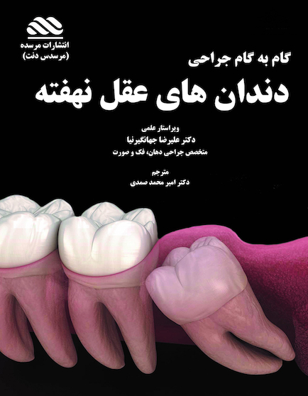 گام به گام جراحی دندان های عقل نهفته