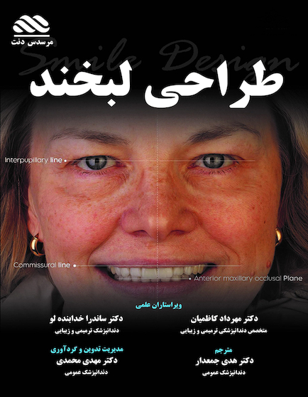 آموزش طراحی لبخند
