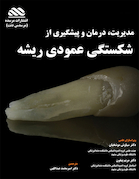 مدیریت درمان و پیشگیری از شکستگی های عمودی ریشه